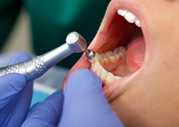 Oral Surgery in Hagerman, ID